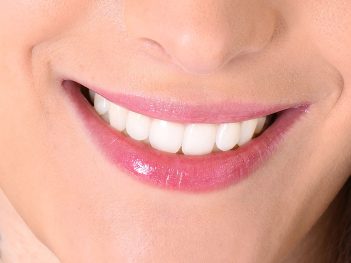 Teeth Whitening Leads in Cosmetic Procedures