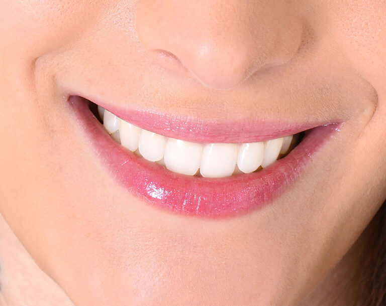Teeth Whitening Leads in Cosmetic Procedures
