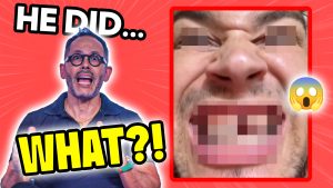 Dr. Luis Sanchez Reacts to the Viral $20 Veneers Video