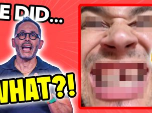 Dr. Luis Sanchez Reacts to the Viral $20 Veneers Video