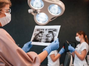 dental cancer screening