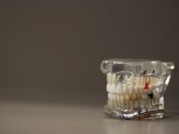 dentistry-668191_640