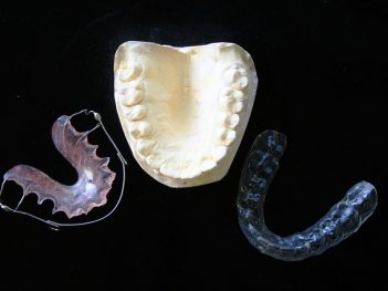 orthodontic-315784_640